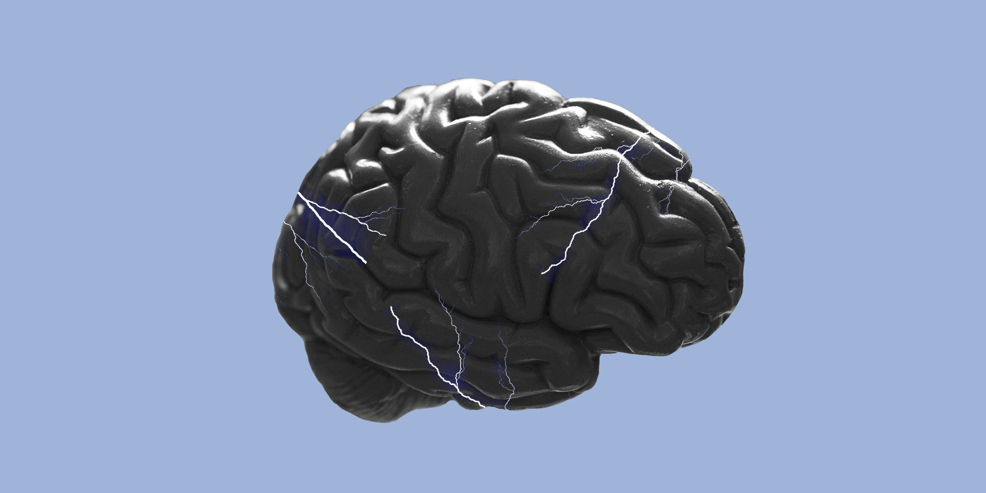 Brain being zapped by shocks. The phenomenon of craving in addiction recovery