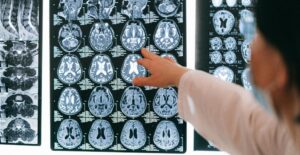 A doctor points at something on a brain scan