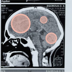 X-ray images of a person's cranium, with peach-colored spots highlighting different sections of the brain. Kinds of cravings and how to combat them.