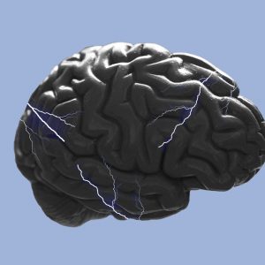 Brain being zapped by shocks. The phenomenon of craving in addiction recovery